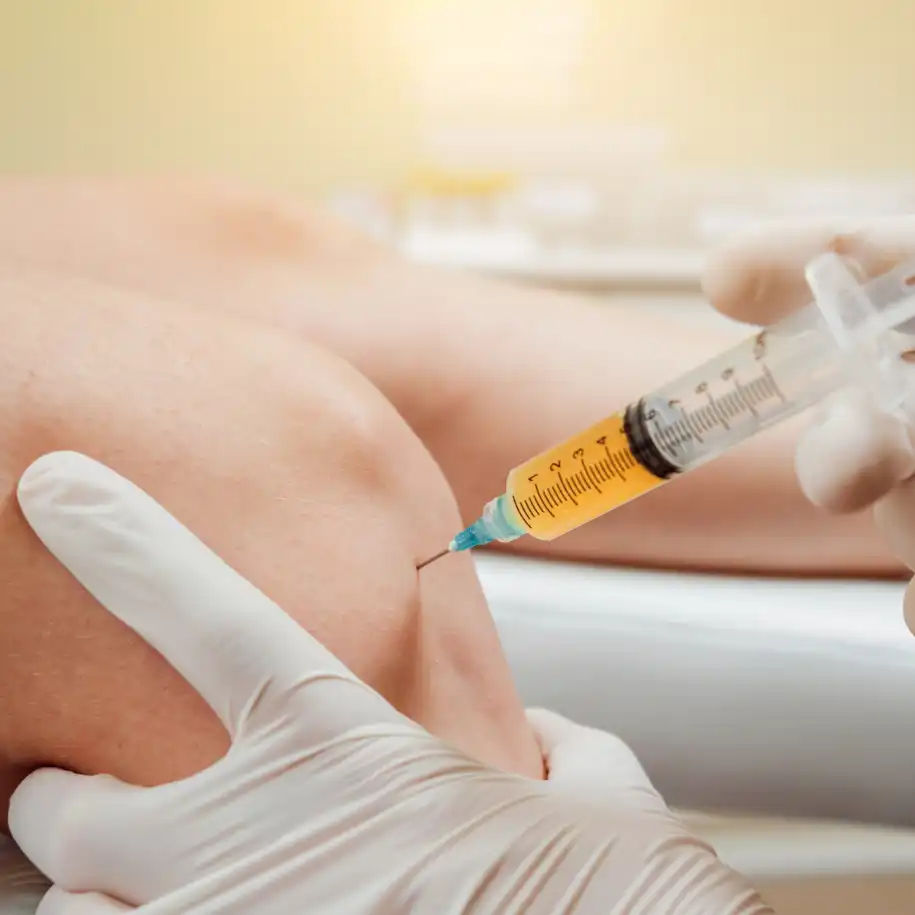 Is Arthrosamid Injection the Long-Term Fix Your Knee Pain Needs