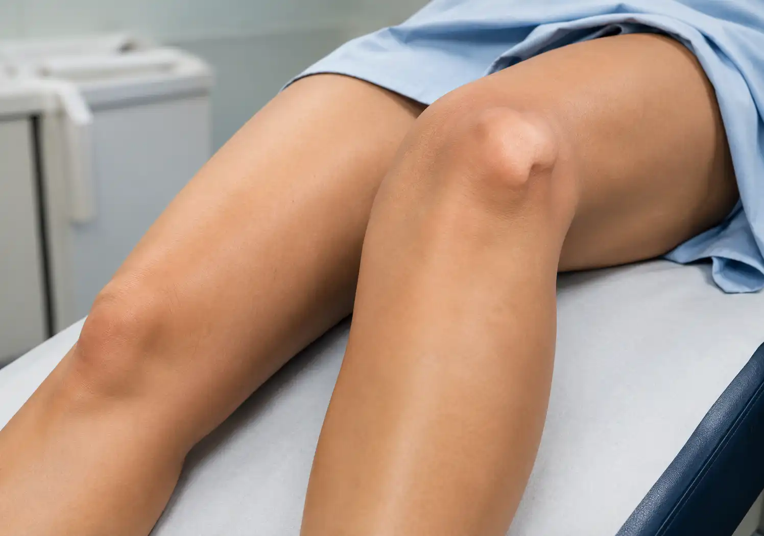 Kneecap Dislocation, What Really Happens the Second It Slips Out