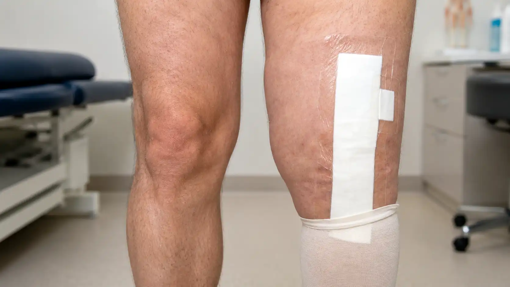 Should You Worry About Swelling After Total Knee Surgery