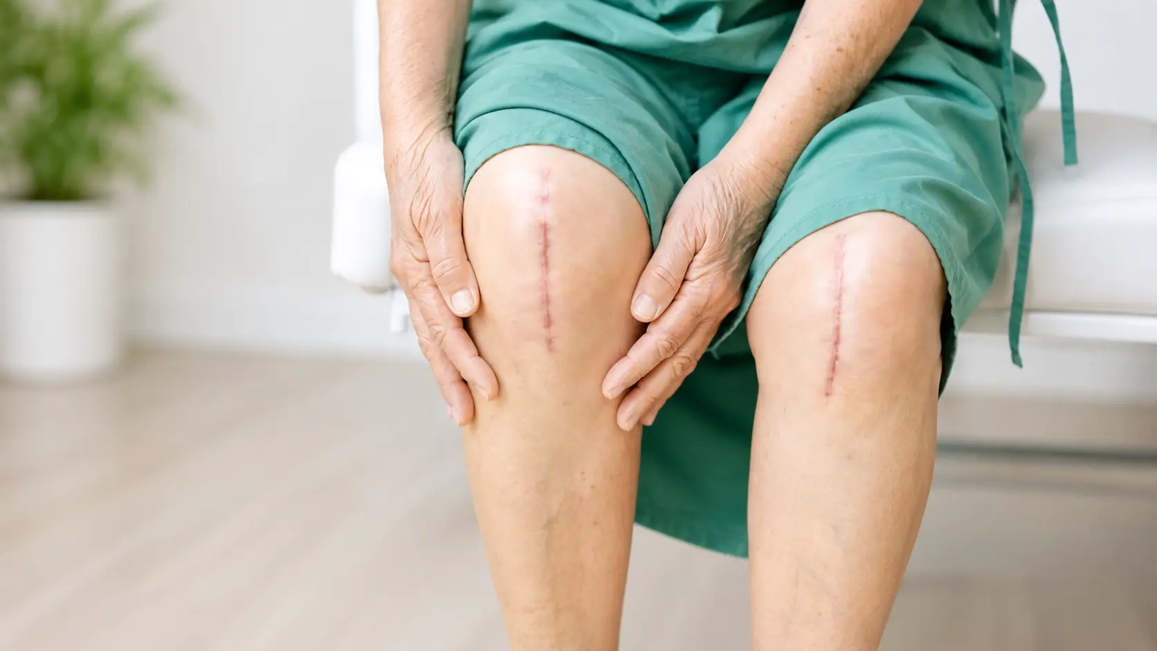 Knee Replacement Recovery Plateaus Are Completely Normal